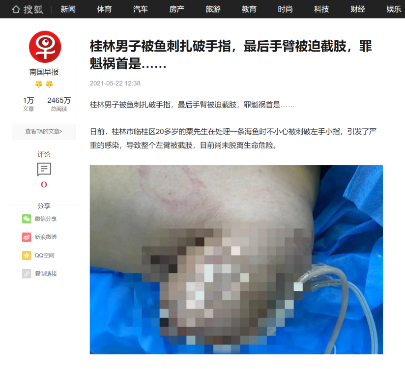 图片 2