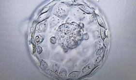 桂北首例 广西壮族自治区南溪山医院助卵子冷冻患者成功获得妊娠